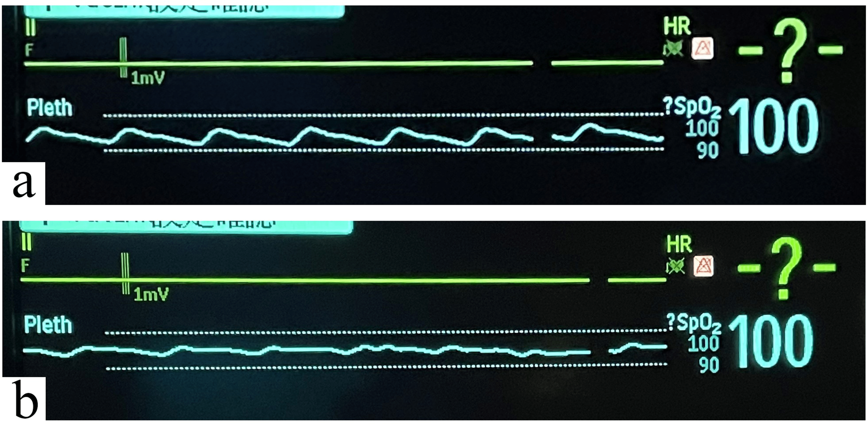 Cureus Simple and Easily Interpretable Flap Monitoring Method Using a