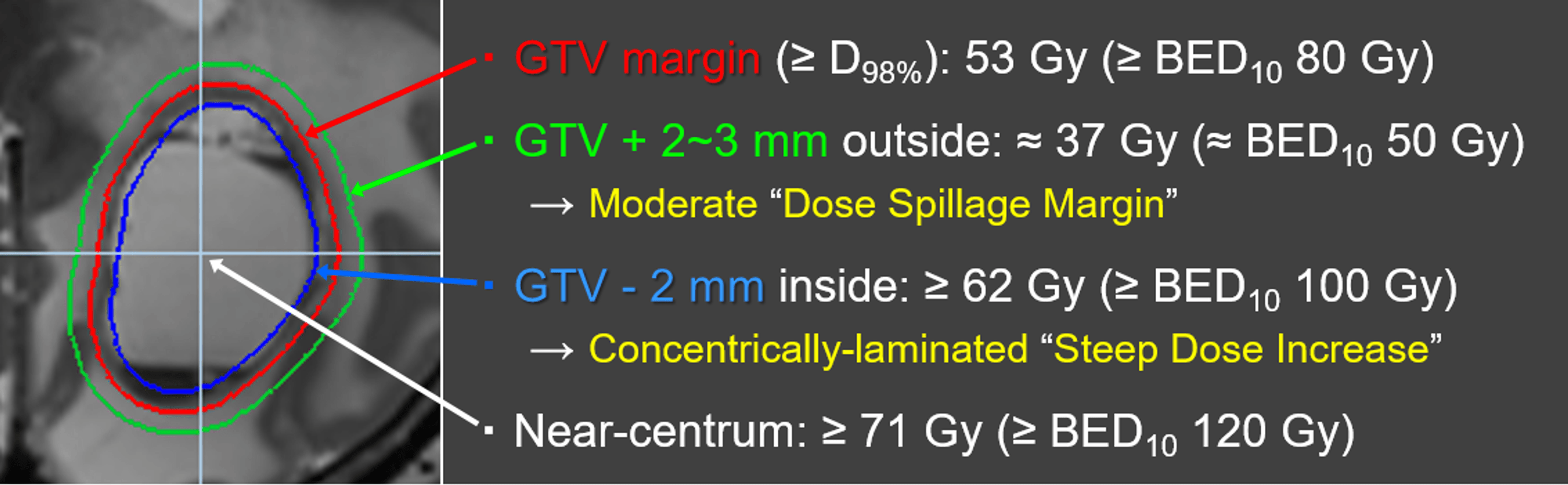 Correlation of Brain Metastasis Shrinking and Deviation During 10