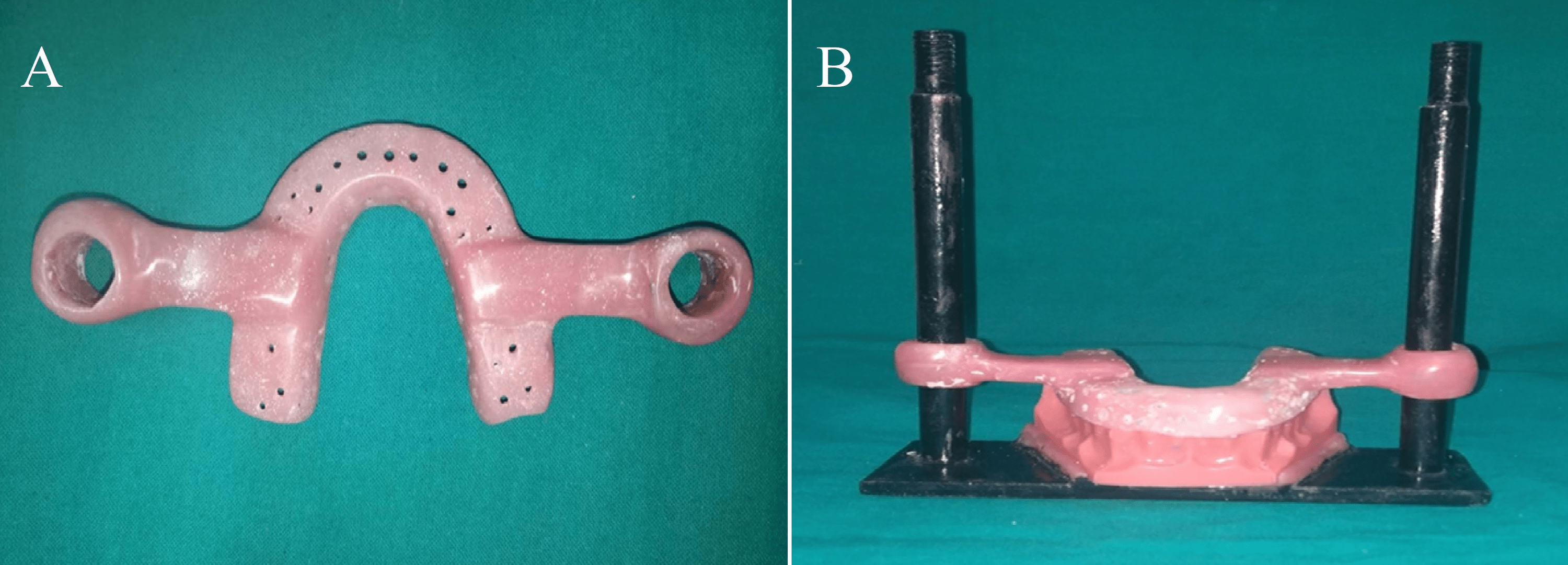 An In Vitro Comparison of Zirconia and Hybrid Ceramic Crowns With Heavy
