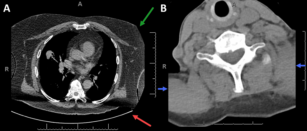 Dosimetrist/Physicist Training Guide - UCSF Radiation Oncology