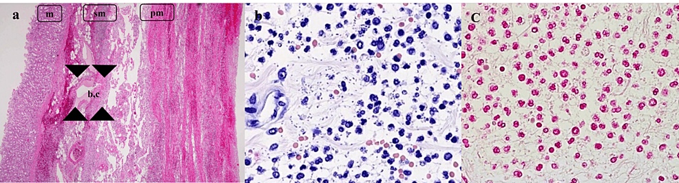Microscopic-view-of-the-stomach.