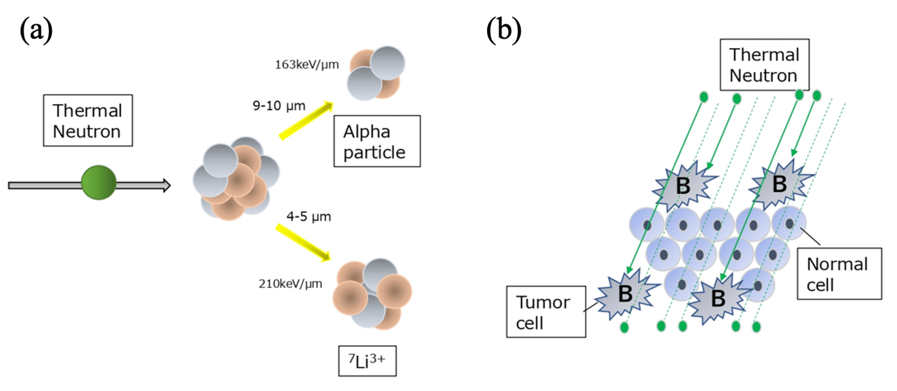 Boron Neutron Capture Therapy For Recurrent Glioblastoma Multiforme ...