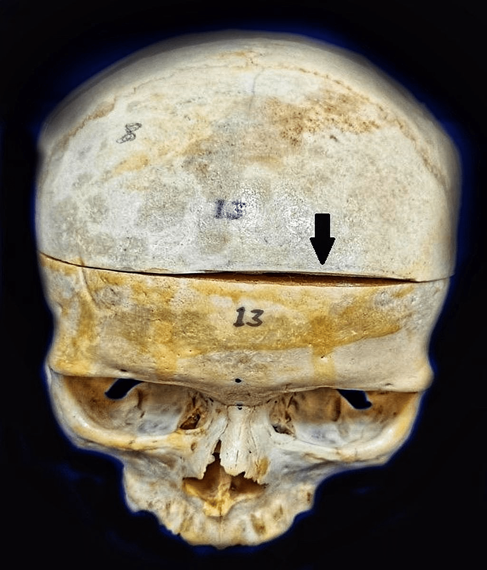 File:Cortex frontal lateral.png - Wikimedia Commons