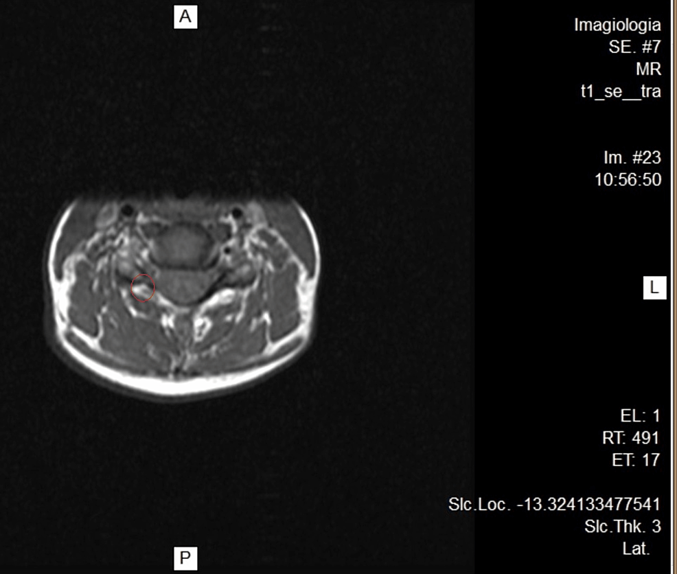 Cervical MRI.