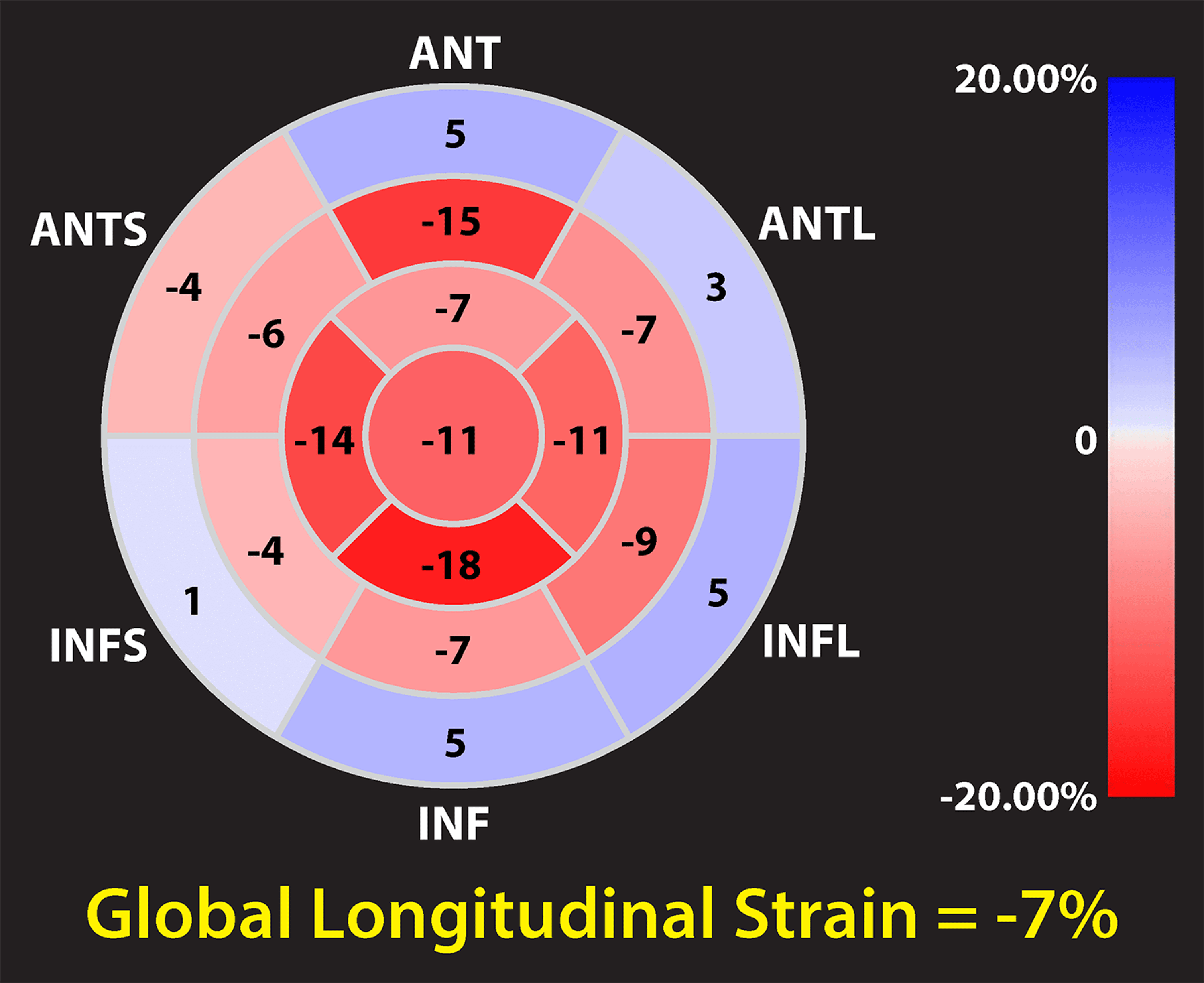 Amyloid Strain Pattern