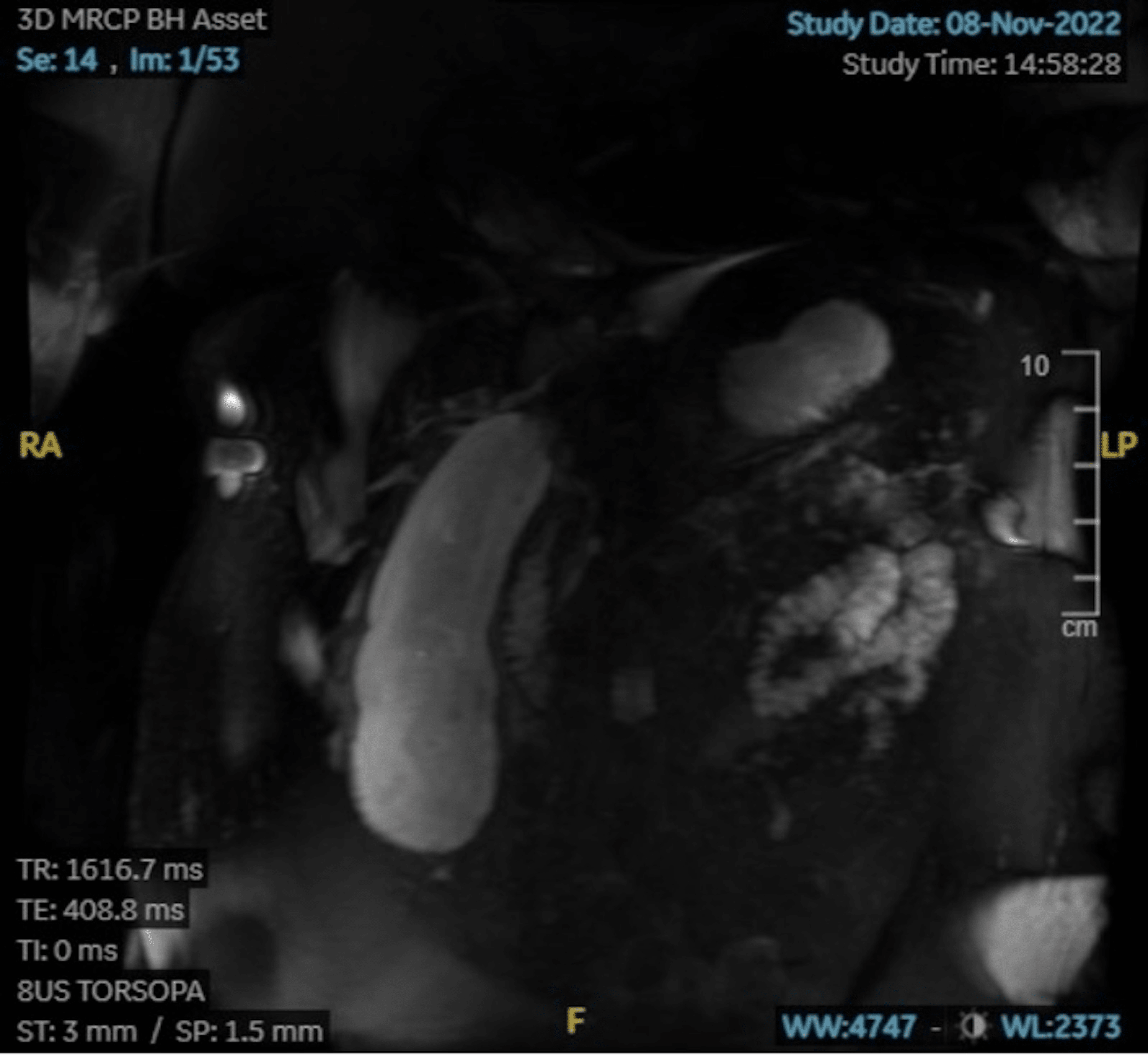 Cureus The Use of Systemic Inflammatory Response Syndrome (SIRS) and