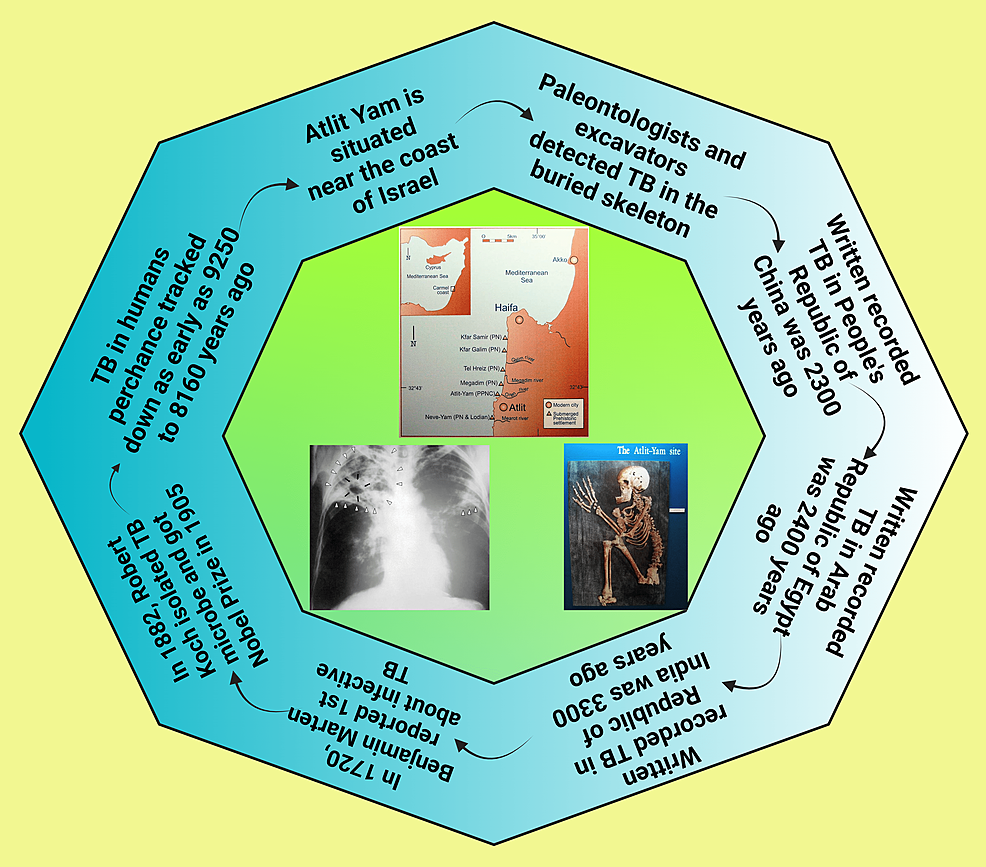 MultidrugResistant TB (MDRTB) and Extensively DrugResistant TB (XDR