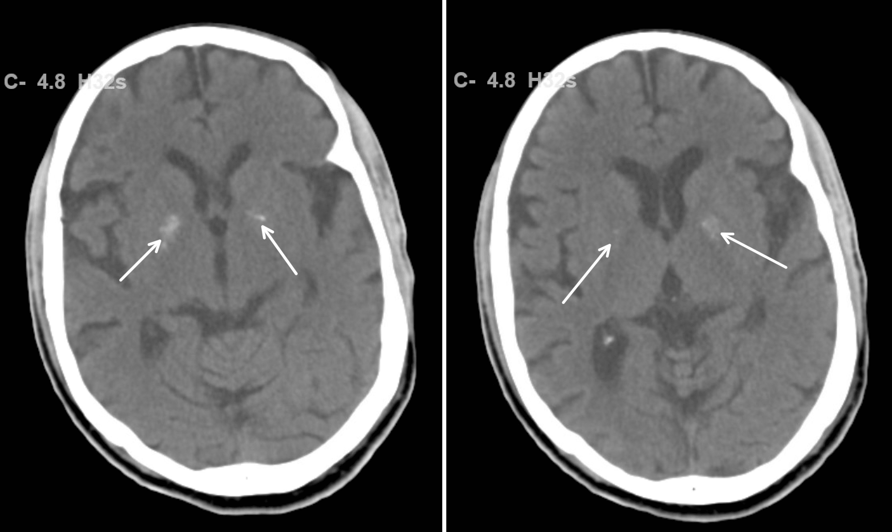 Cureus | False-Positive Human Immunodeficiency Virus Results in COVID-19  Patients | Article