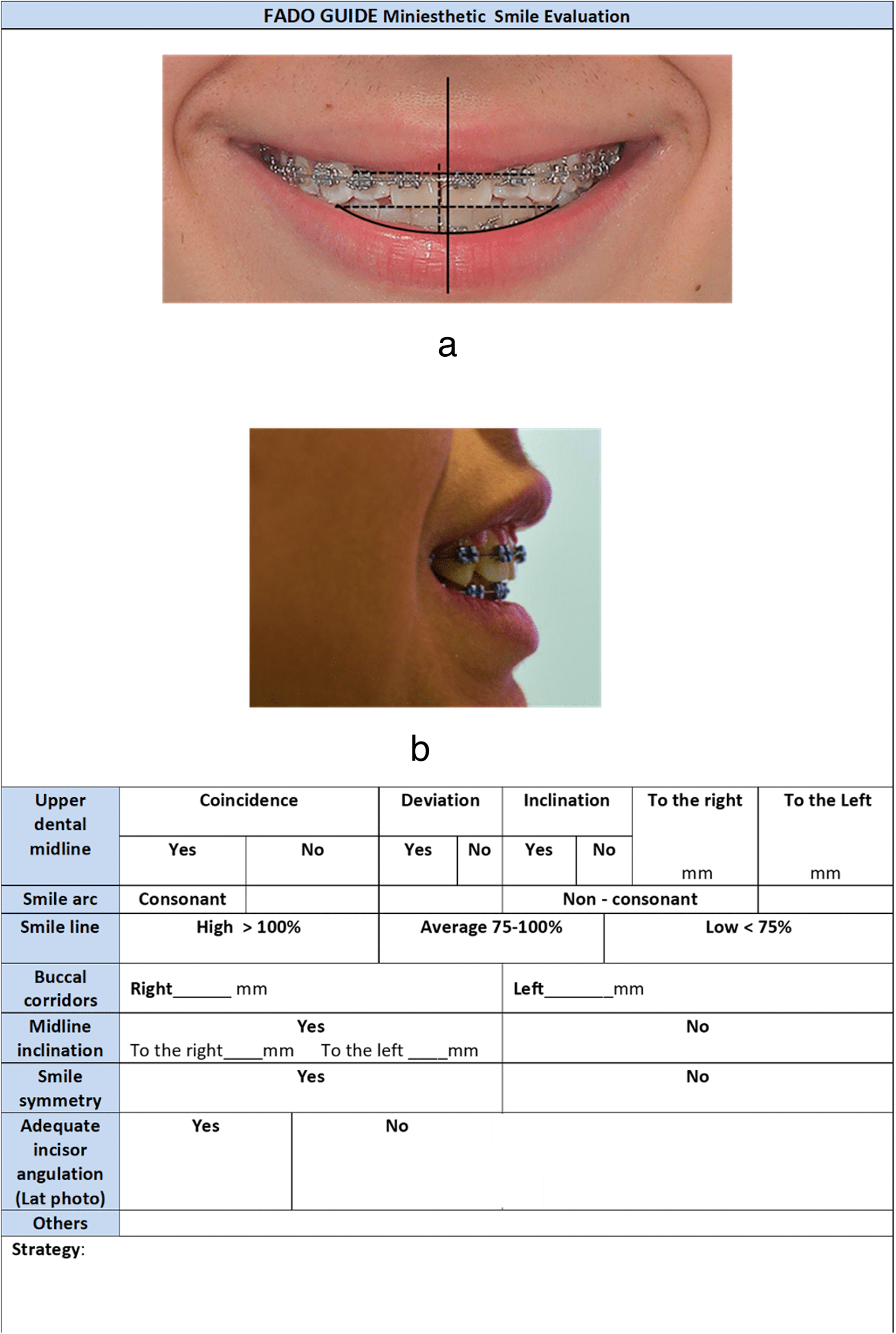Cureus Finishing Analysis of Dental (FADO) as a New Guide in
