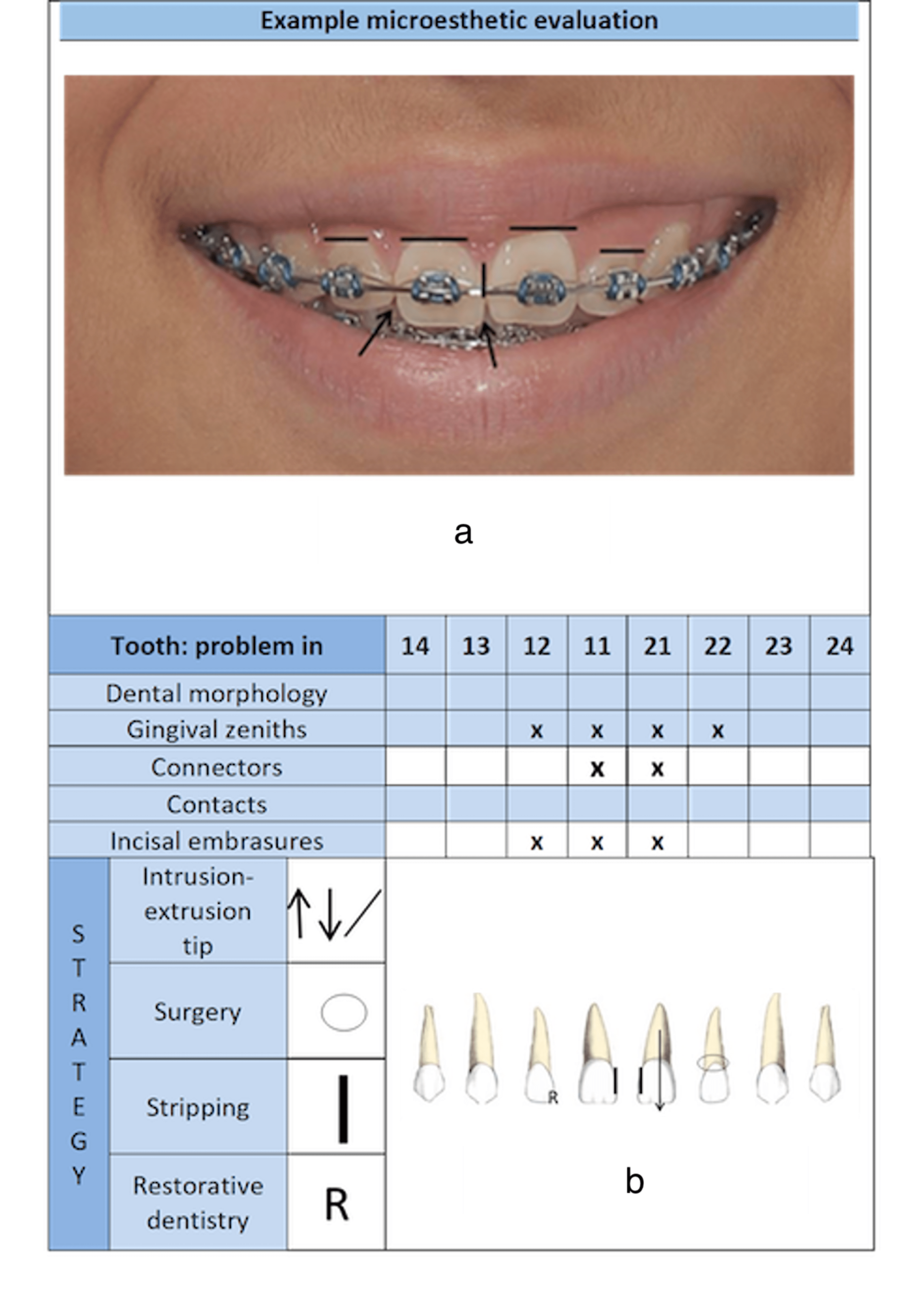 Zwfmockaitis Orthodontics 92