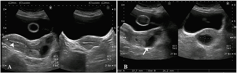 Transabdominal-ultrasound-images.