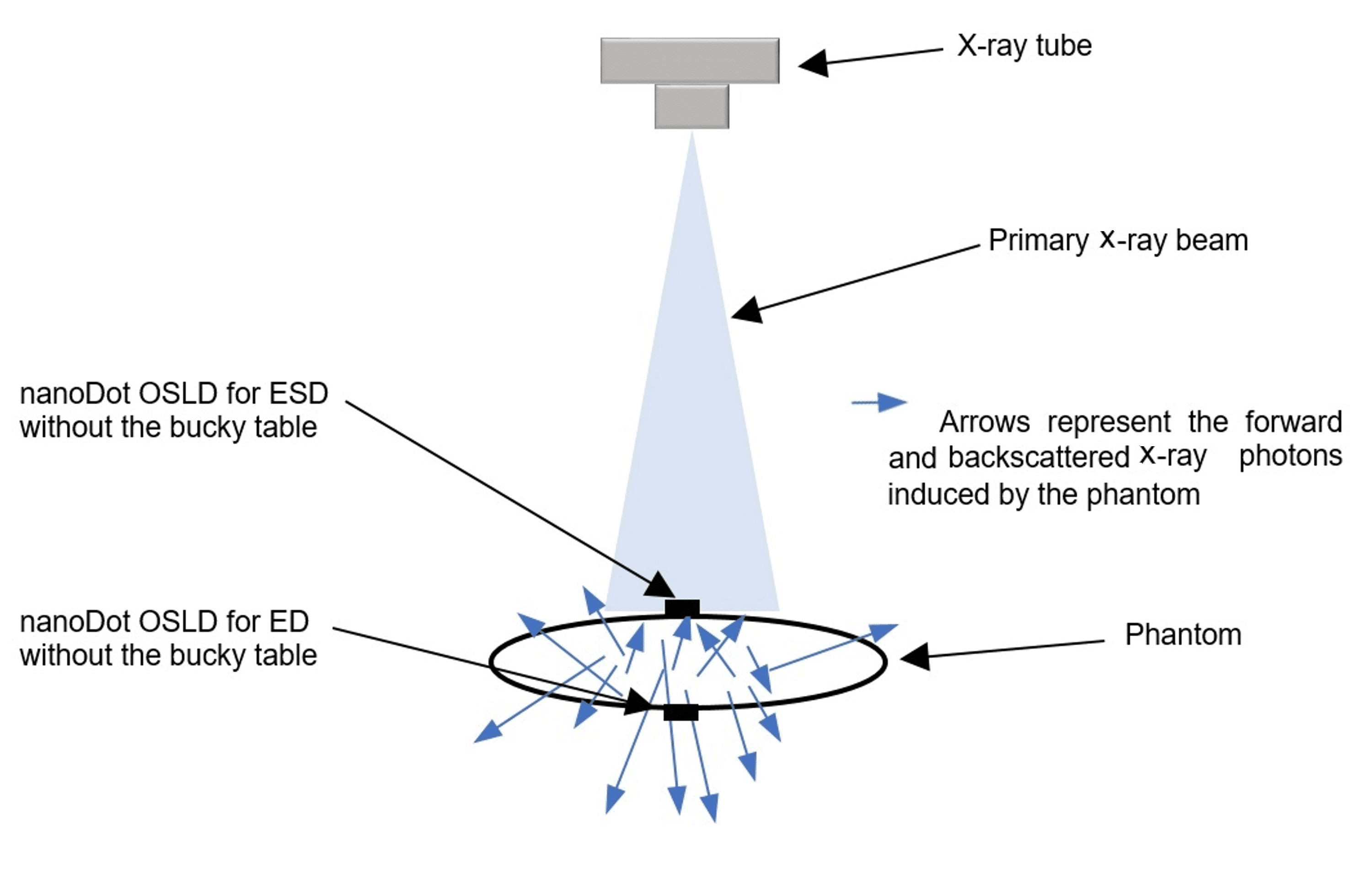 Cureus Entrance Skin Dose (ESD) and Bucky Table Induced Backscattered