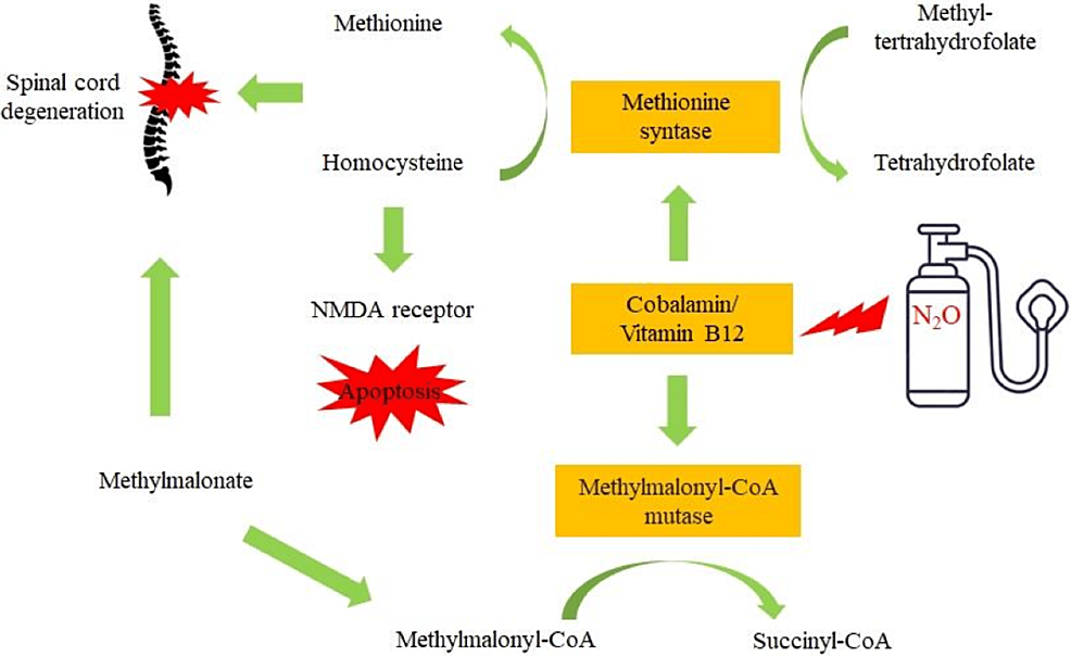 A Case Report Of Subacute Combined Degeneration Due To Nitrous Oxide ...