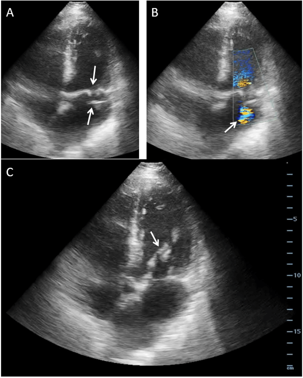 Bedside-transthoracic-echocardiography