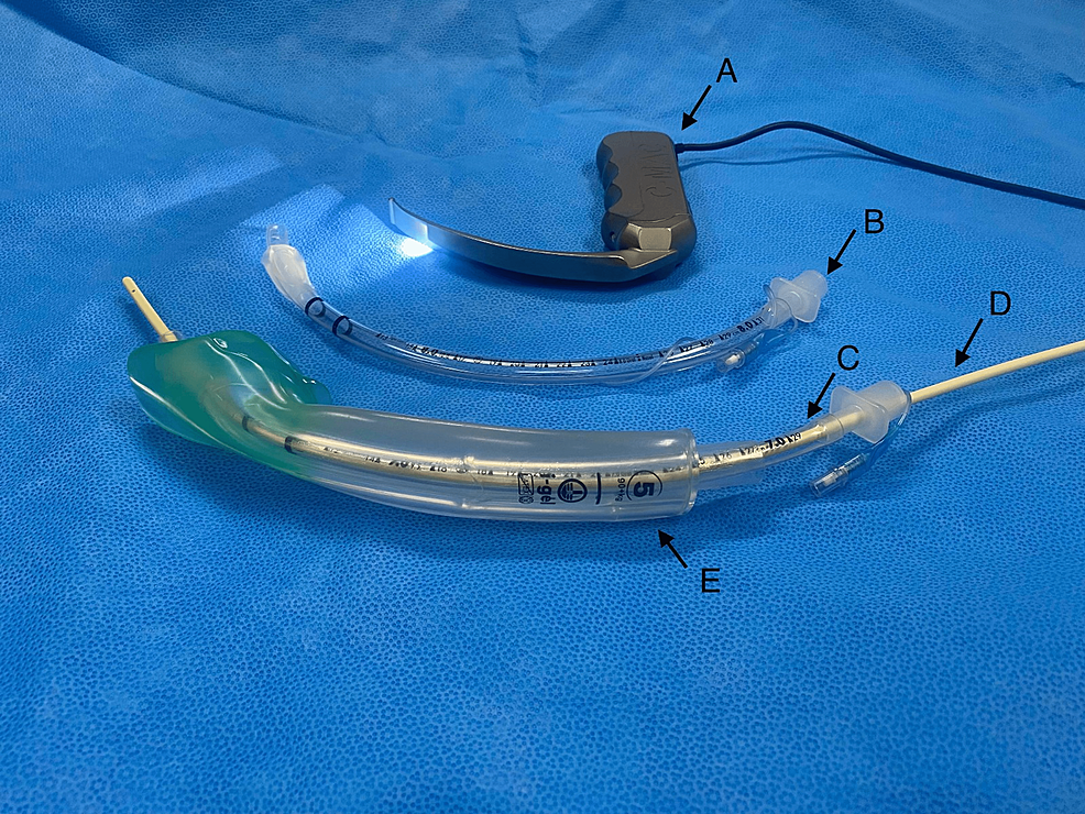 BronchoscopeGuided Airway Rescue via an Igel™ for HaematomaInduced