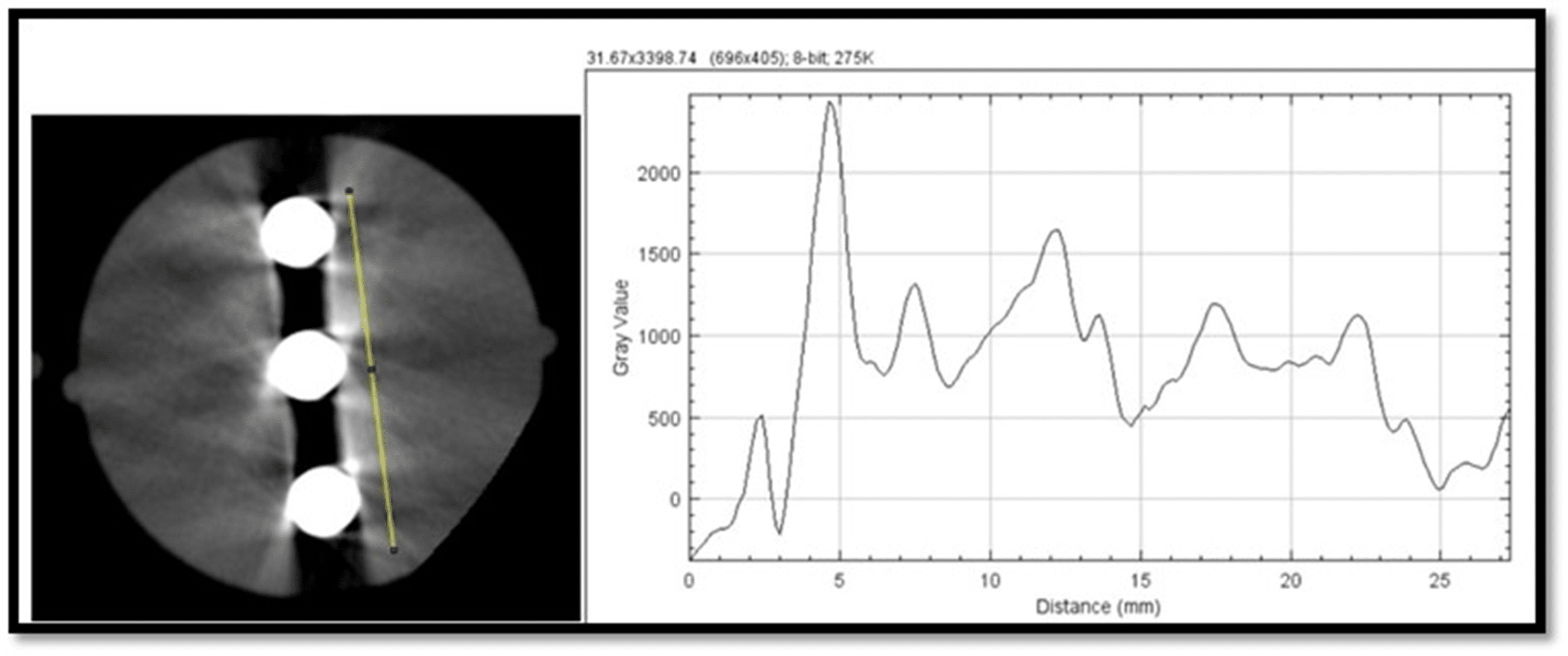 Cureus Effect of a Motion Artifact Correction System on ConeBeam