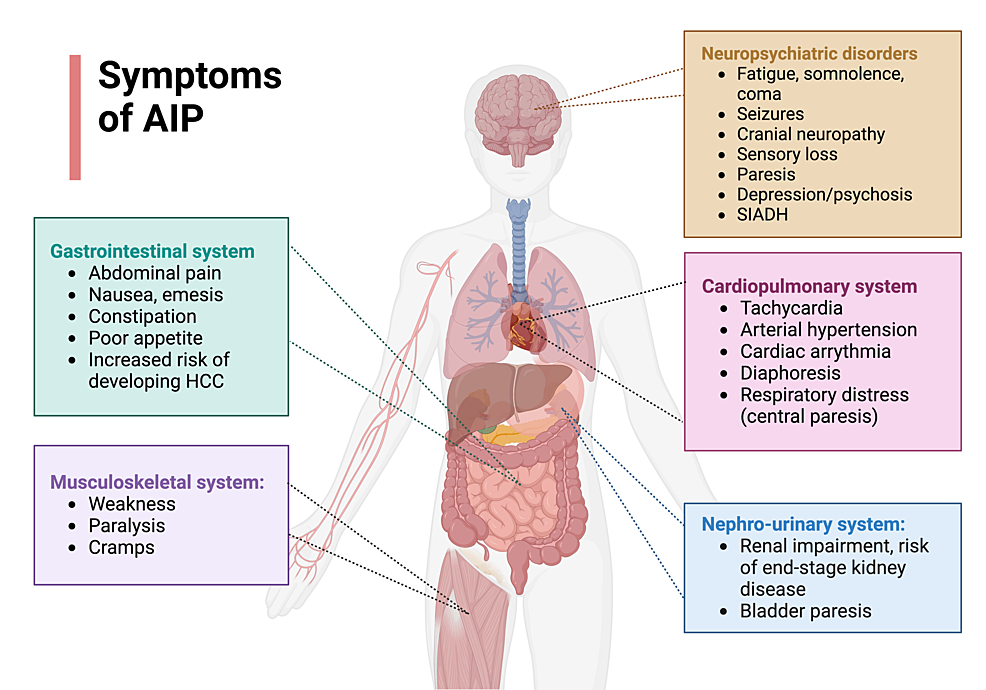 Acute Intermittent Porphyrias Symptoms And Management A Narrative Review Cureus 7084