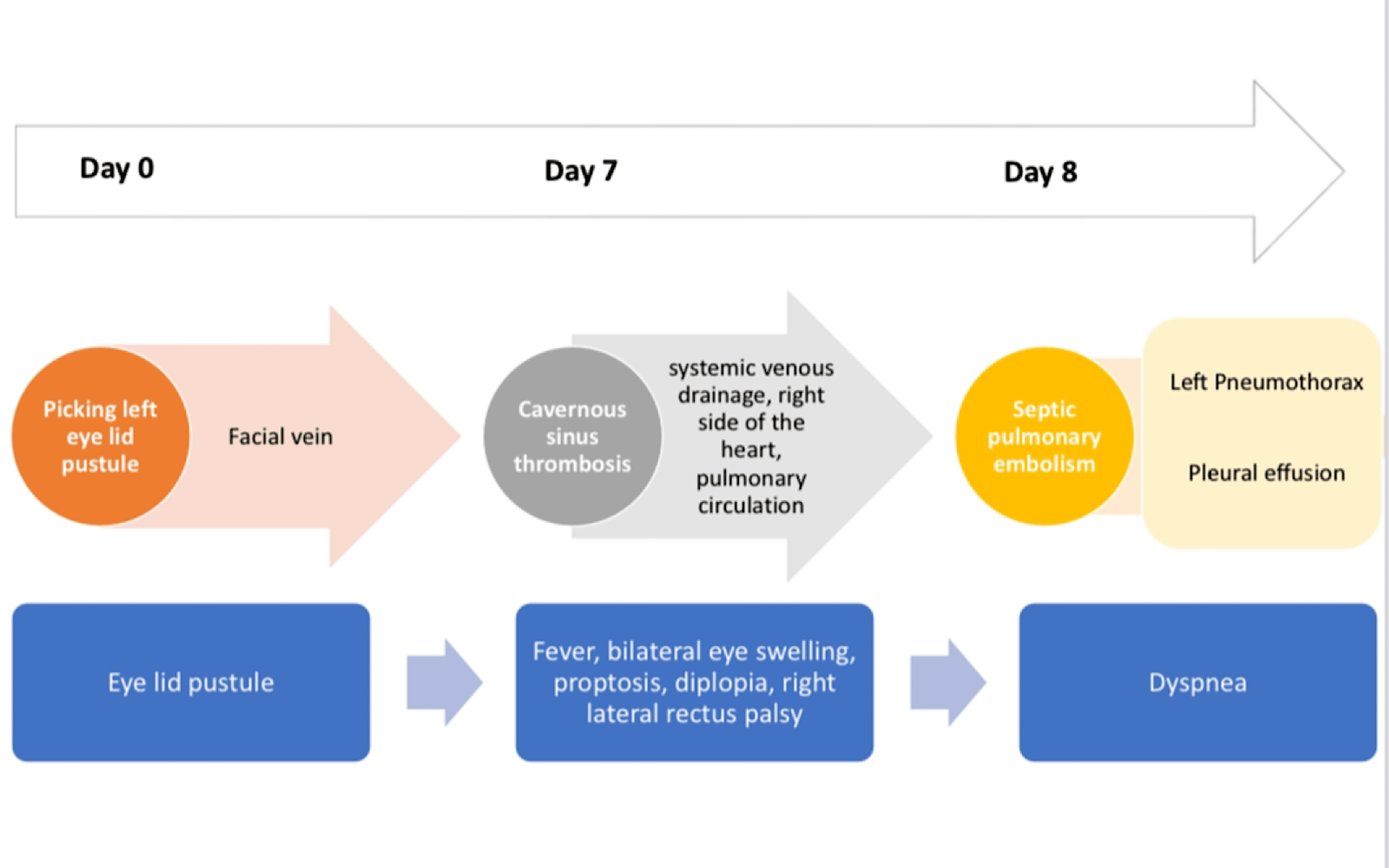 Cureus Septic Cavernous Sinus Thrombosis in a Young Male Presenting