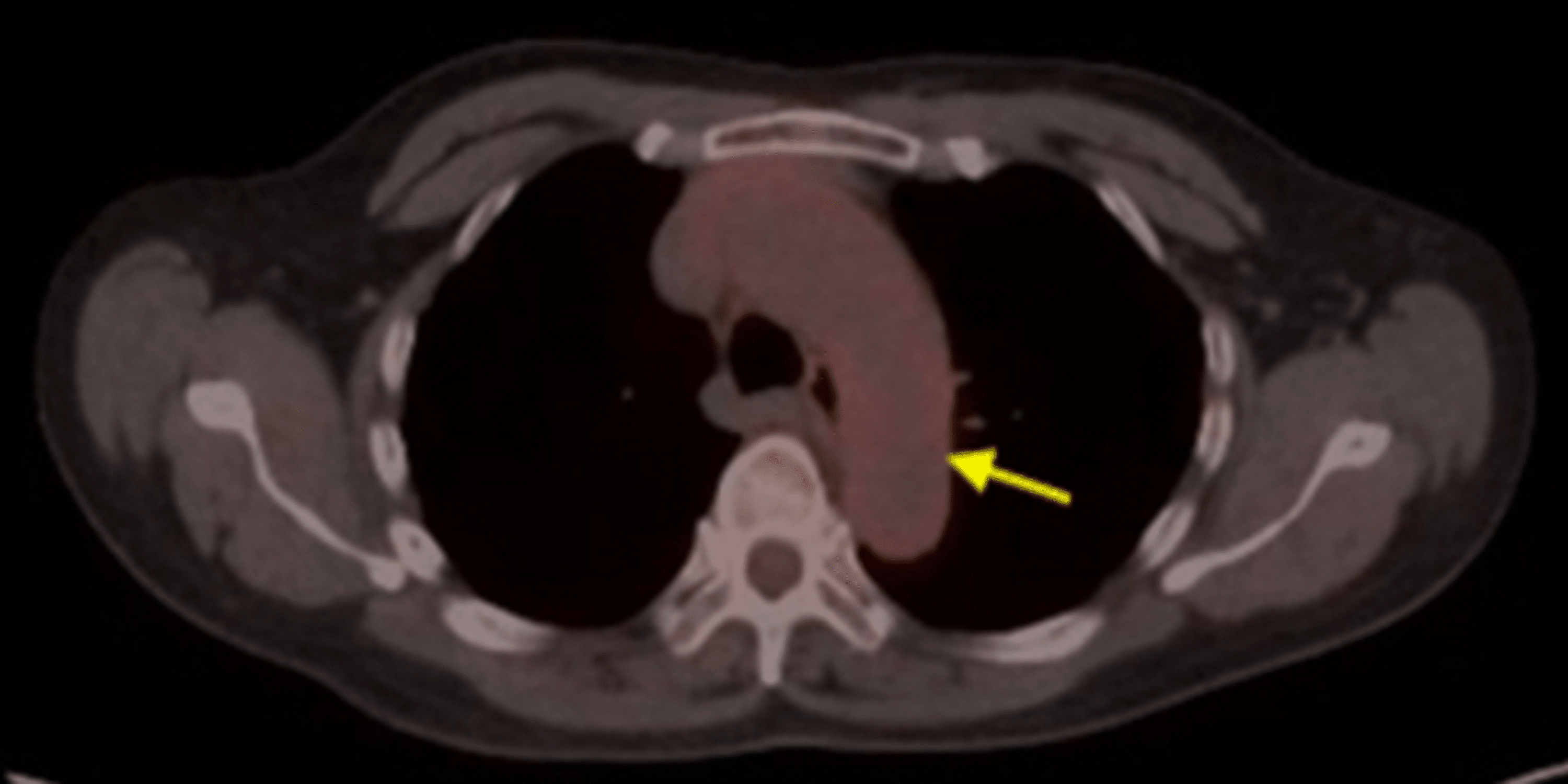 what does a ct scan show for dogs