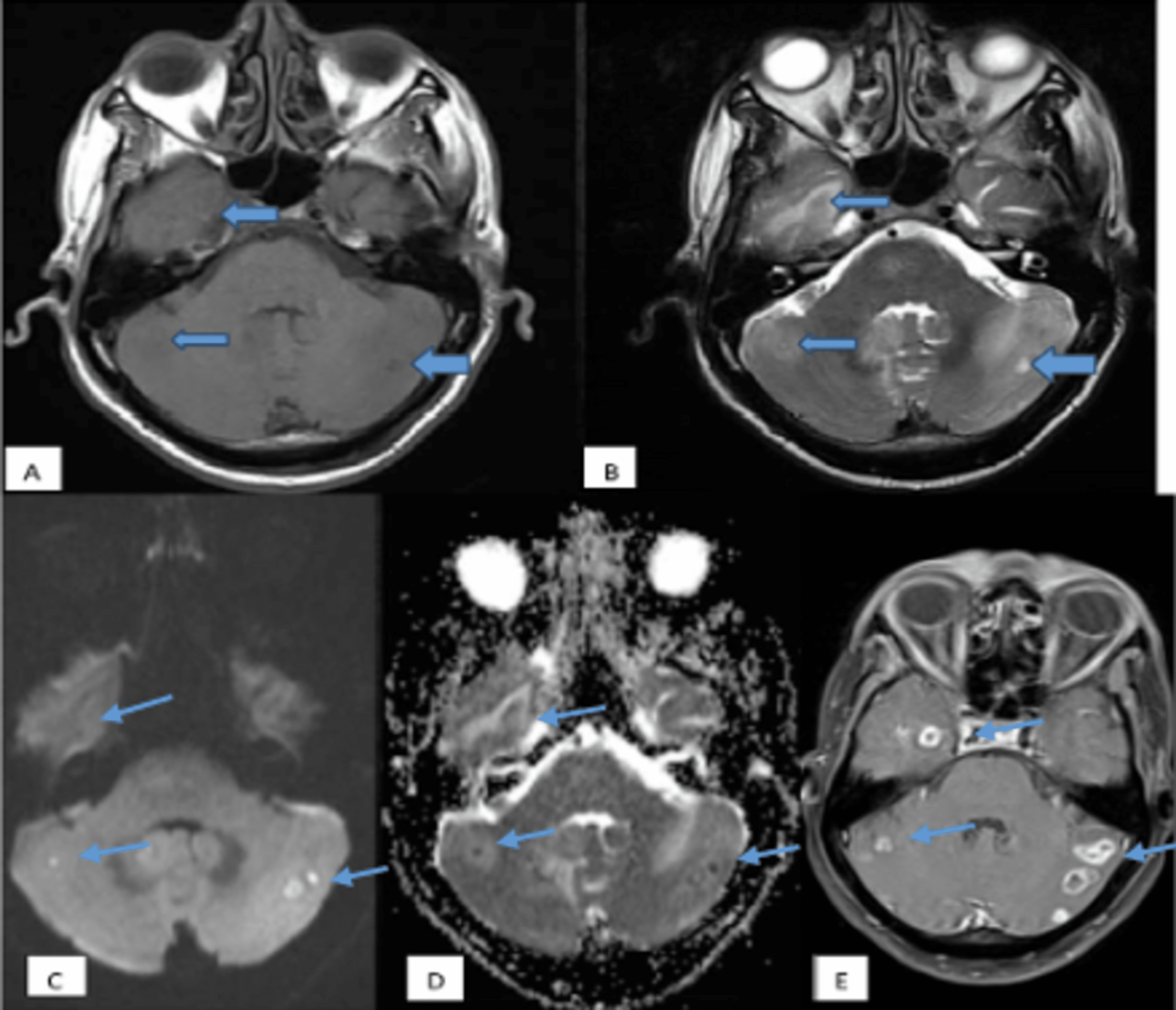 Cureus | Role of Multiparametric Magnetic Resonance Imaging of the ...