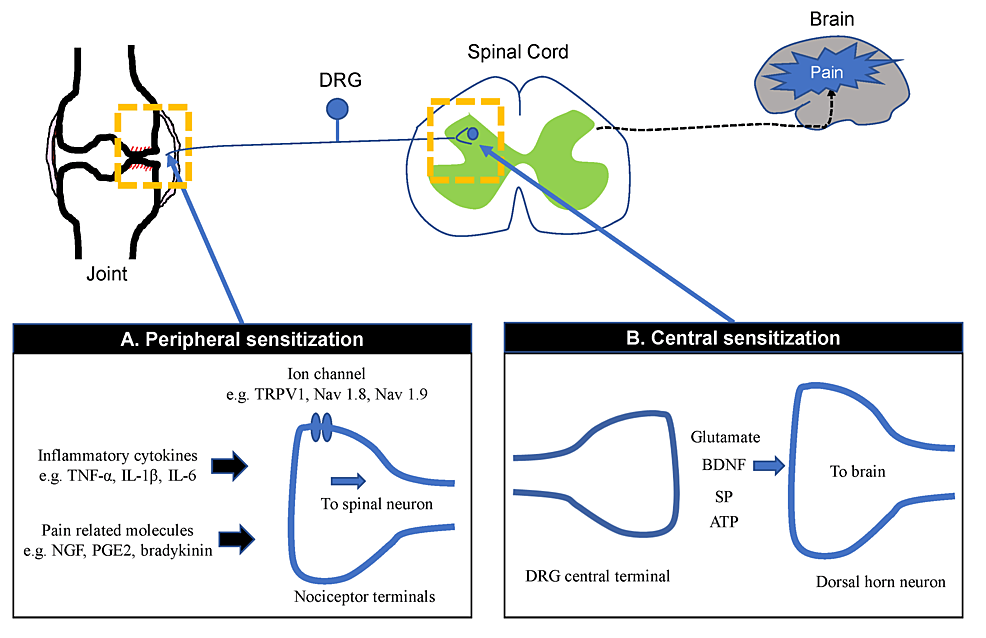 cureus-mechanisms-of-peripheral-and-central-sensitization-in