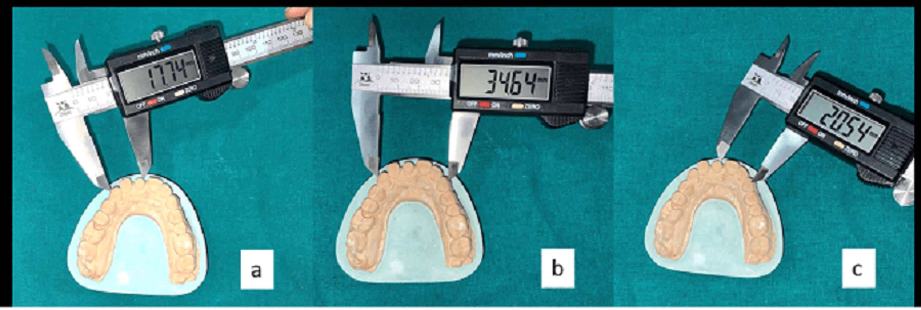 Comparative Analysis of Three Different Impression Techniques for