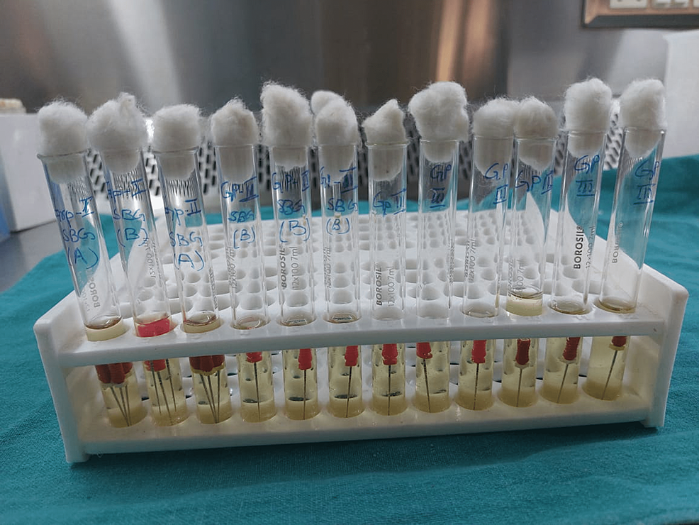 Cureus Sterilization of New Endodontic Hand Files Stored in Dental