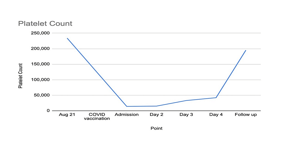 Thrombocytopenia Secondary to COVID-19 Vaccination: Side Effects or Coincidence?