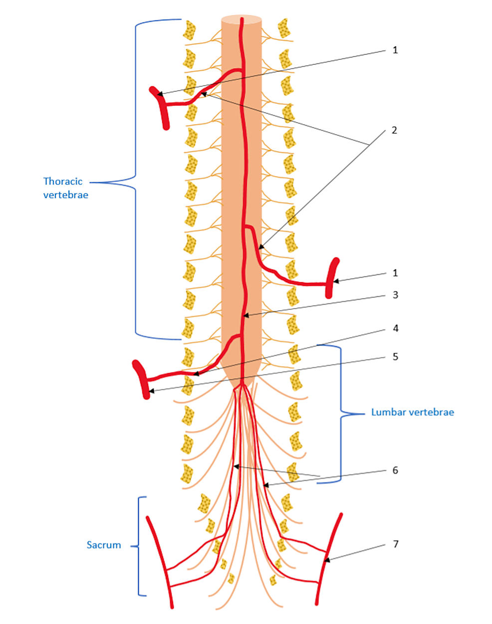 Patrón correlativo entre el daño arterial segmentario y el trastorno neurológico completo después de una lesión de la médula espinal: un estudio de casos y controles