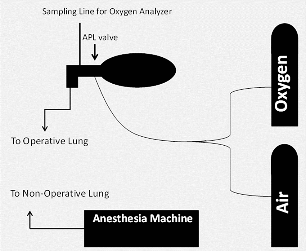 Prophylactic Use of Continuous Positive Airway Pressure to Operative ...