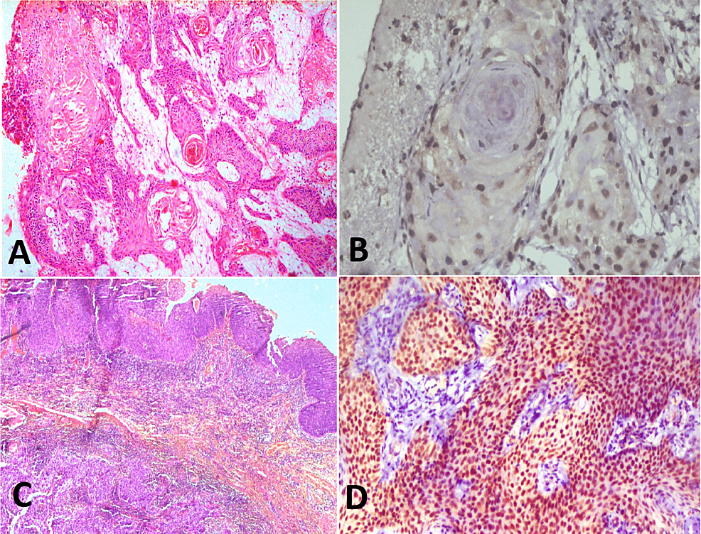 cureus-evaluation-of-immunohistochemical-expression-of-enhancer-of