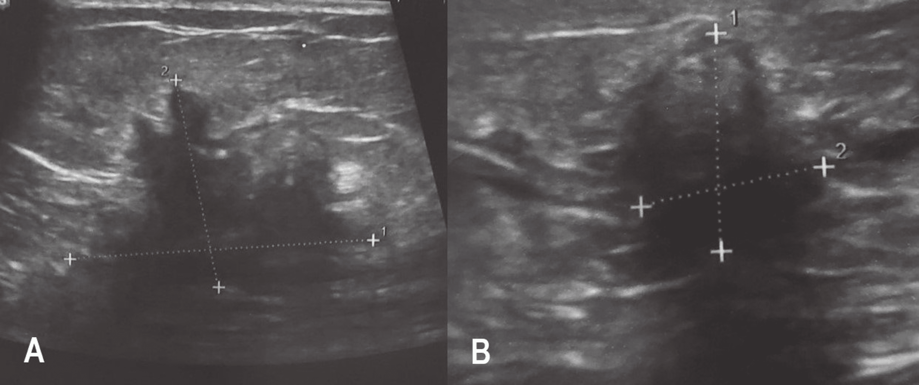 Cureus Utility of Ultrasound Imaging Features in Diagnosis of Breast