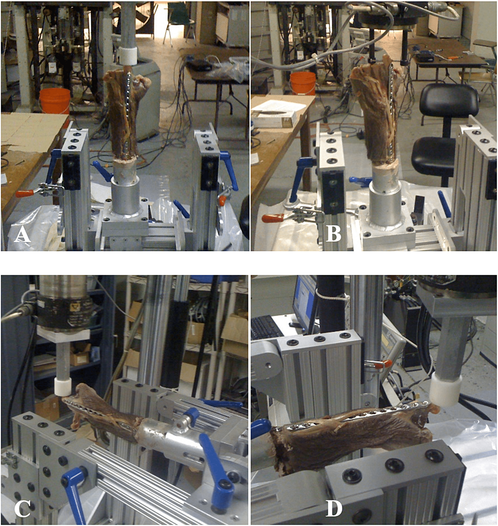 Biomechanics Of Subcutaneous Locked Plating Versus Burke Plate And External Fixator For