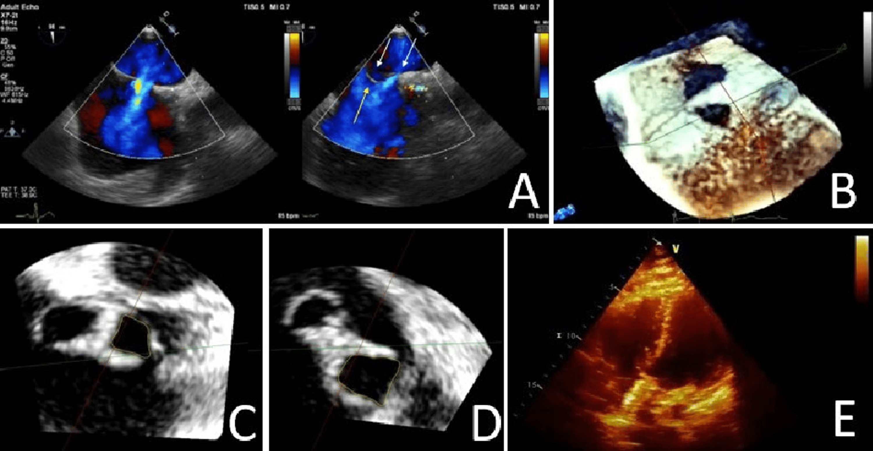 ThreeDimensional Cardiac Imaging A Necessity to the Diagnosis and