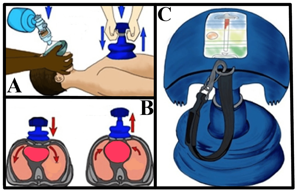 Chest compression methods used in the trial: (A) Standard position; (B)