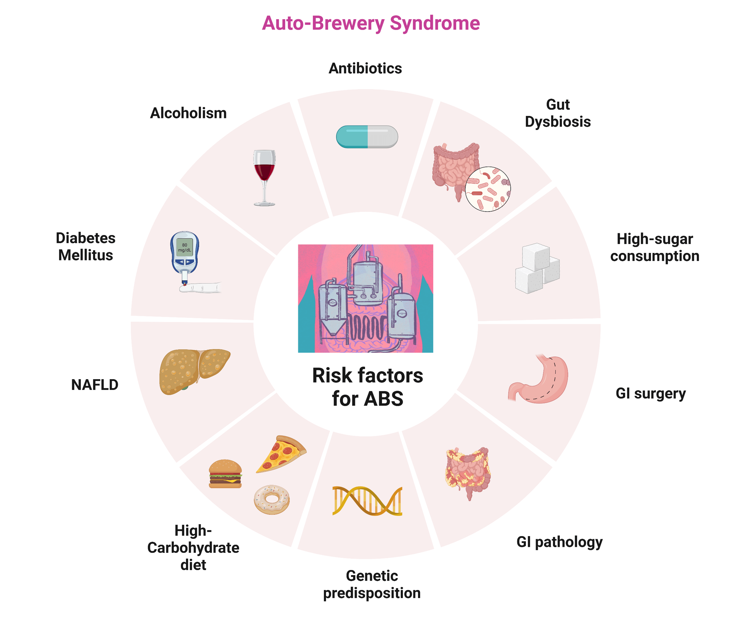 Cureus Understanding AutoBrewery Syndrome in 2023 A Clinical and Comprehensive Review of a