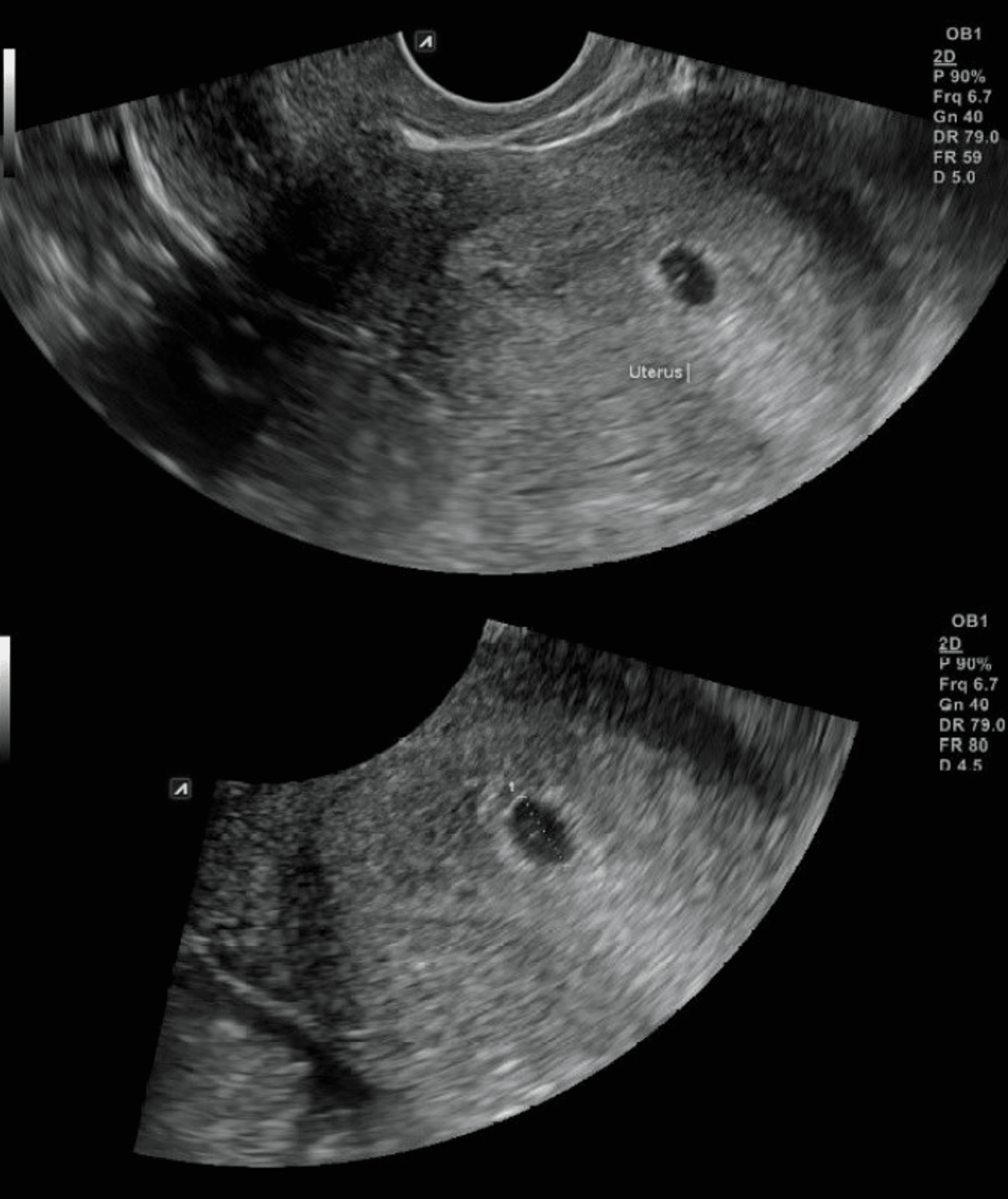 Pregnant Empty Sacjake Burton Stu - cfvcg98