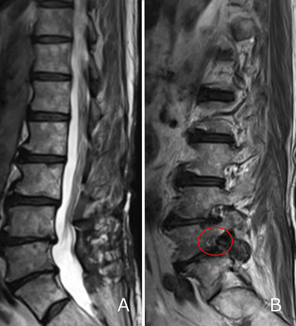 Sciatica - Atlantic Medical Group