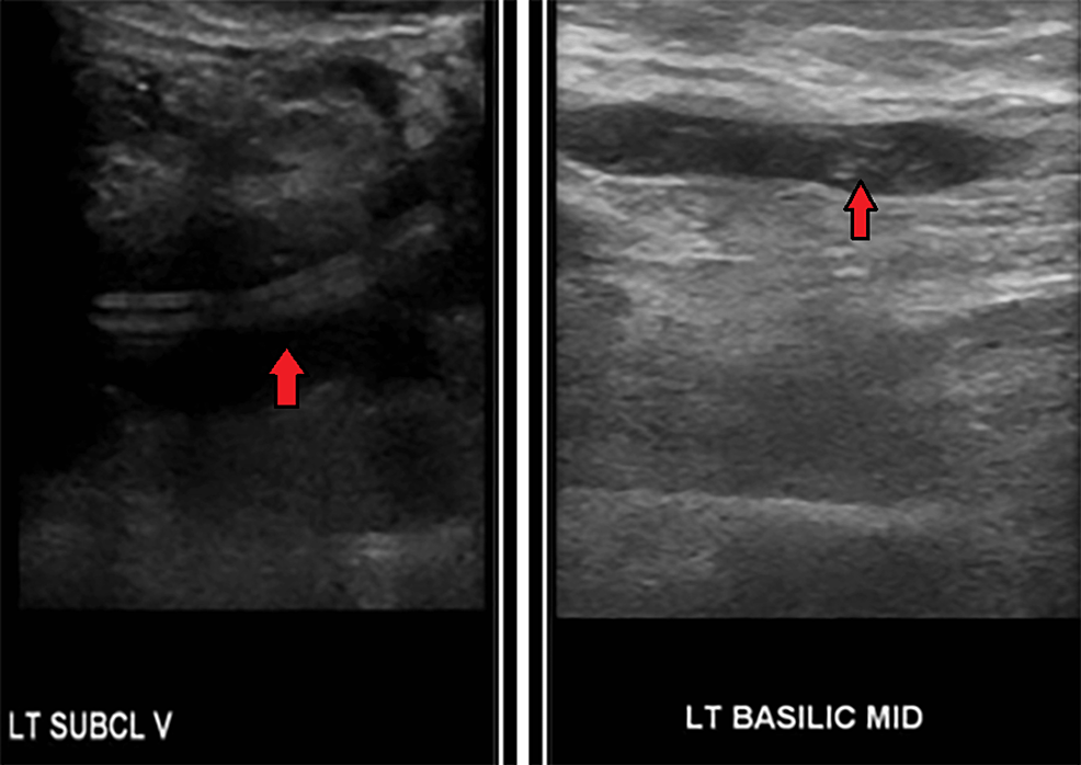 Cureus Exploring the Causal Relationship Between Arterial and Venous