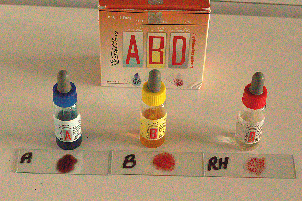 ABO-Rh Combination Blood Typing Kit, 32 Tests