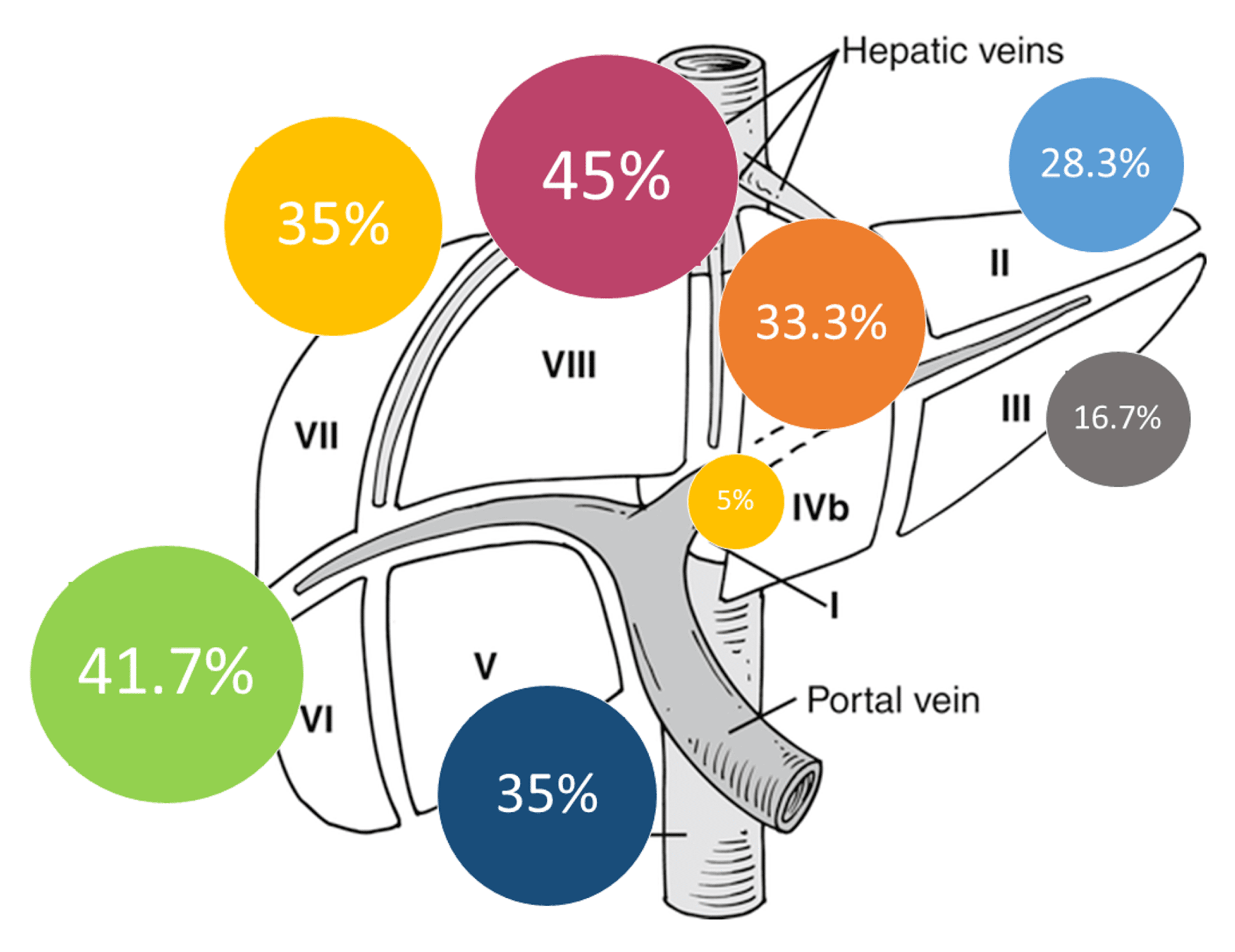 Cureus Laparoscopic and Open Liver Resections for Colorectal Cancer