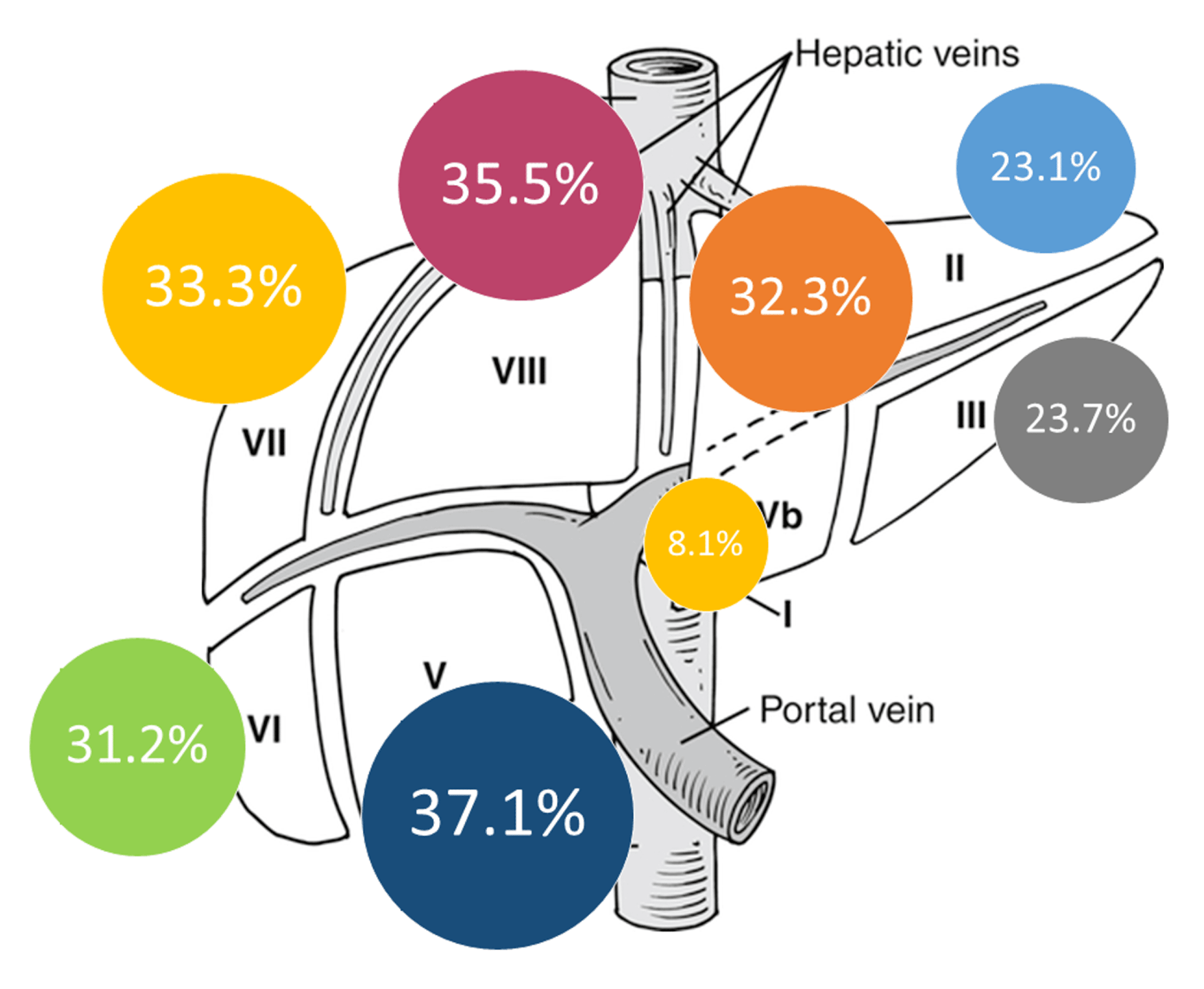Cureus Laparoscopic and Open Liver Resections for Colorectal Cancer