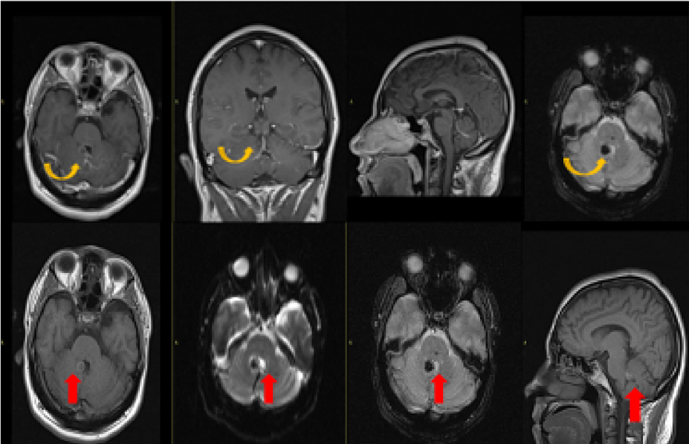 Magnetic-Resonance-Imaging-with-Contrast