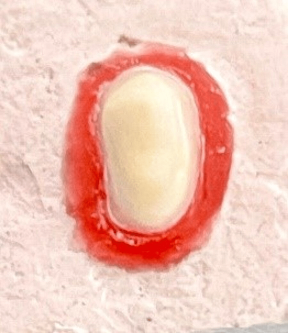 Cureus Comparative Effect of No Finish Line, Heavy Chamfer, and