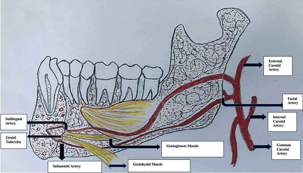 Dental implants: Mandibular neurovascular considerations 