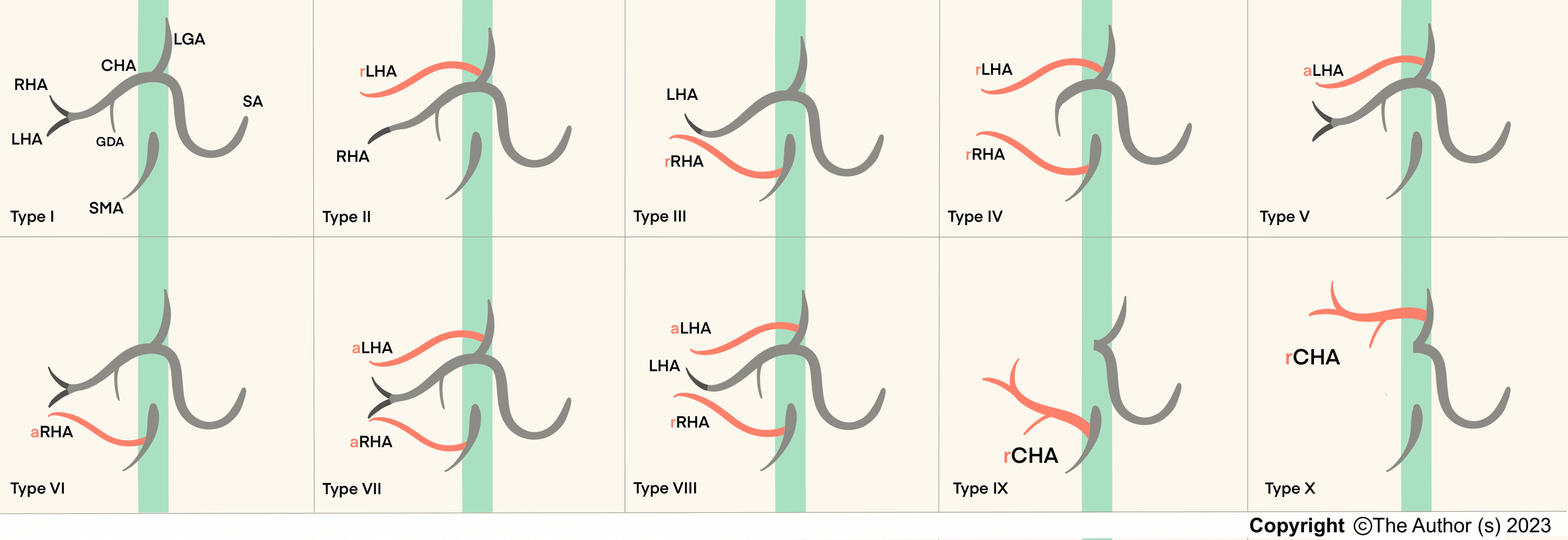 Exploring Anatomical Variations Of Abdominal Arteries Through Computed ...