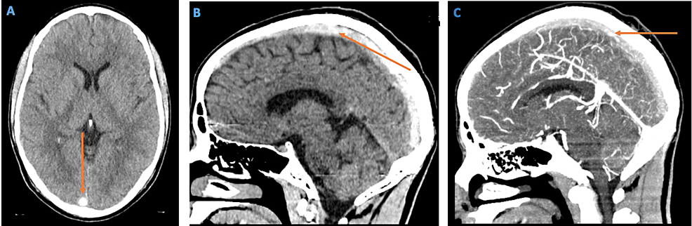 Ct Scan Image