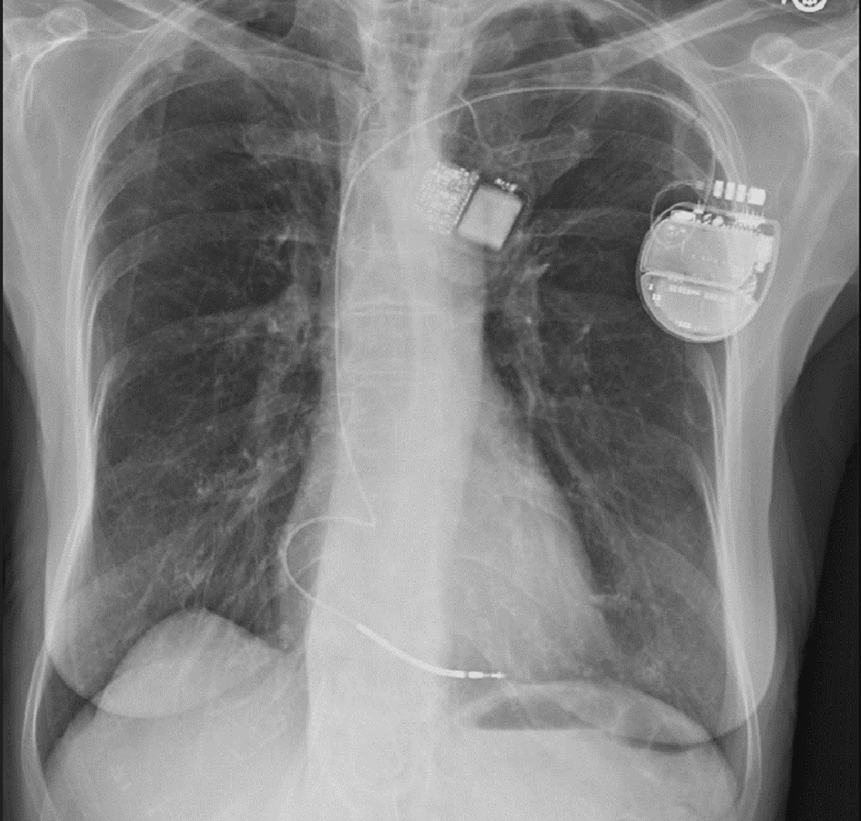 Chest Radiograph Wikidata