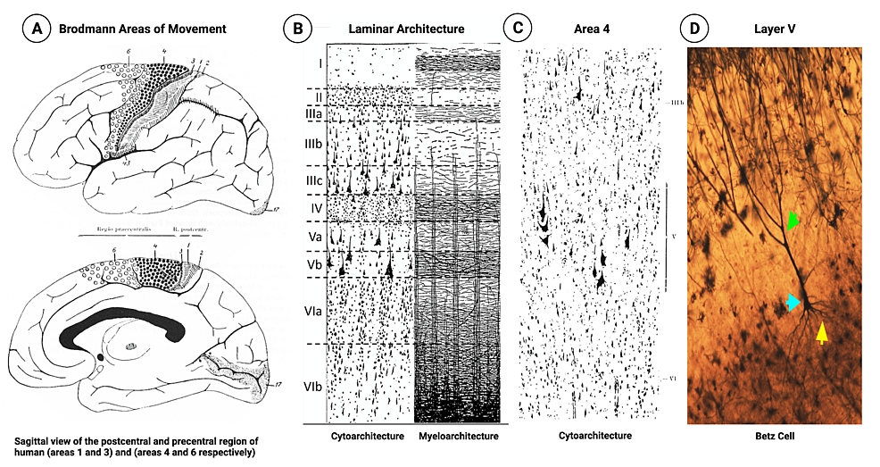 Cureus, Brainstem and Spinal Arachnoiditis Ossificans Associated With  Neurocysticercosis: A Case Report