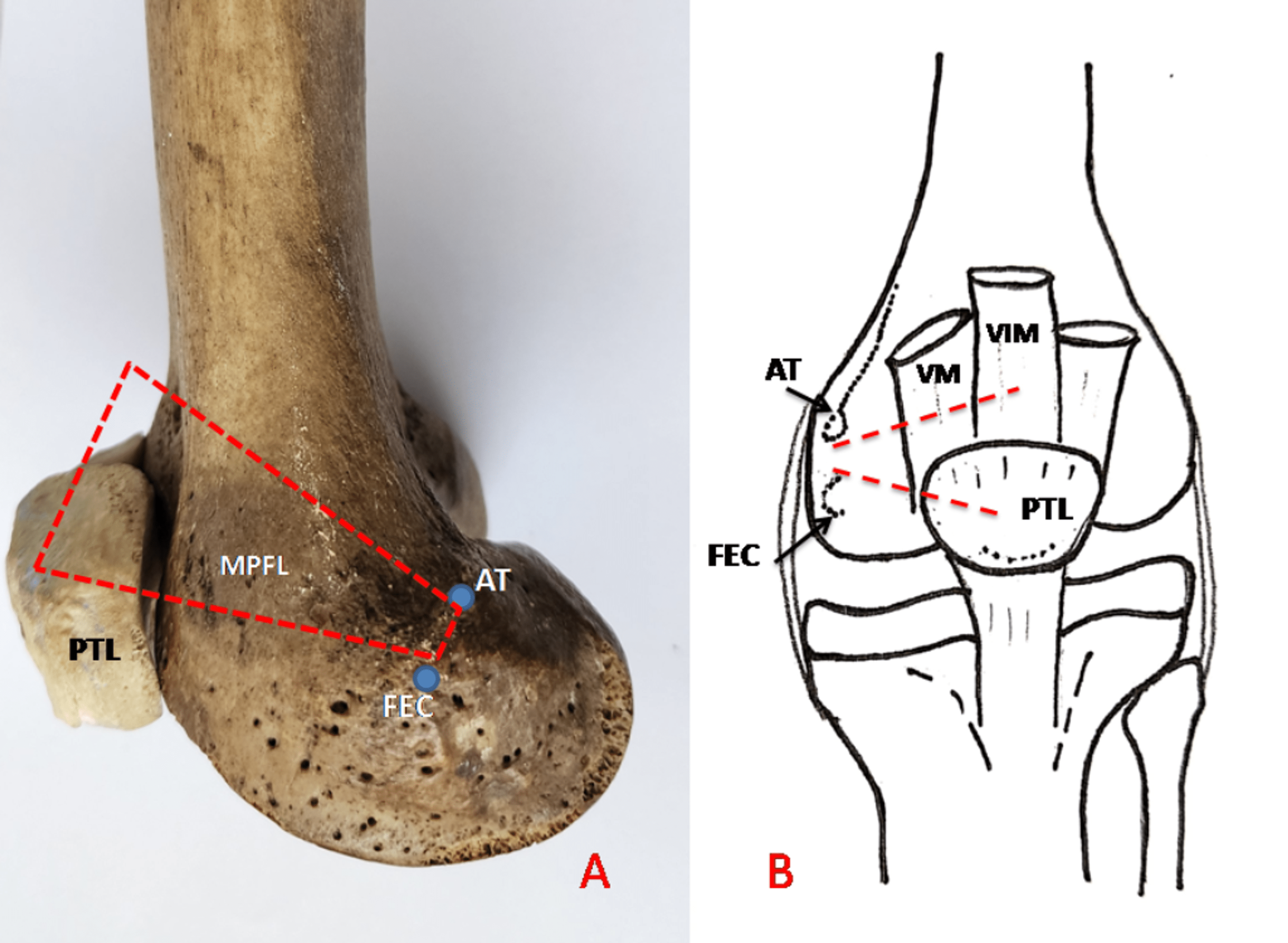 Cureus | Cadaveric Study to Define the Anatomy of the Medial ...